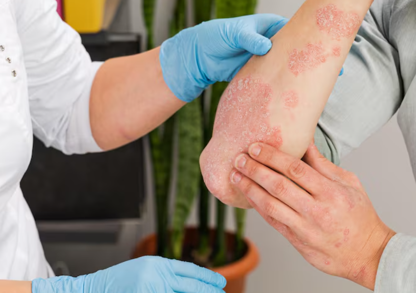 Día Mundial de la Lucha contra la Lepra: visibilizar para prevenir y sanar.